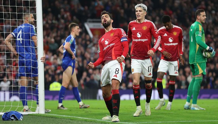 Sức mạnh và phong độ của Manchester United vs Leicester City